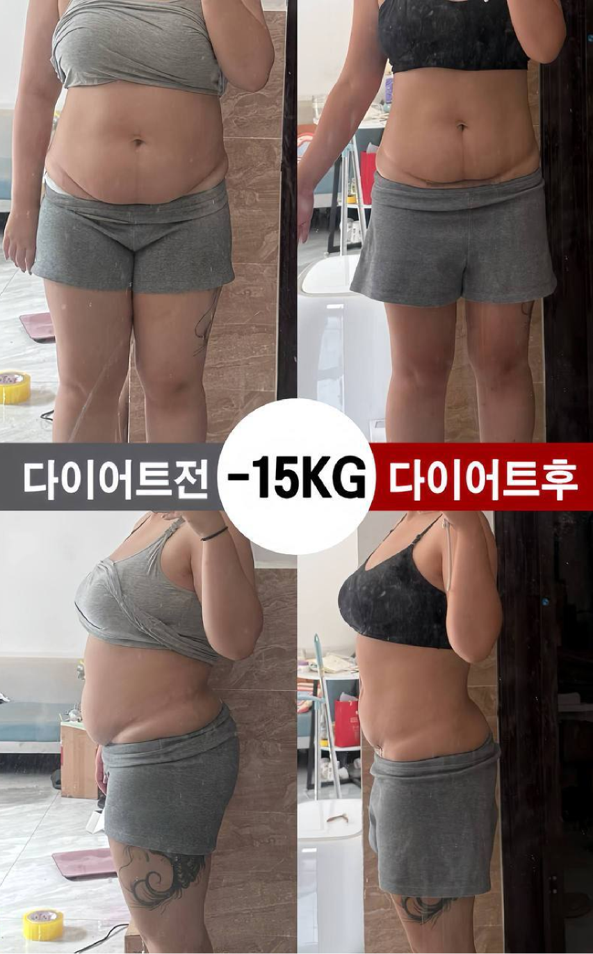 체중 관리 사례