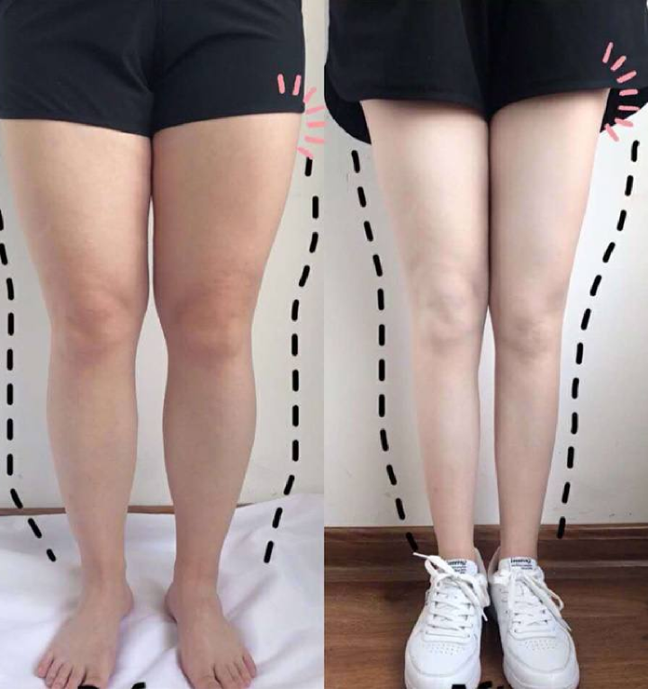 체형 관리 사례